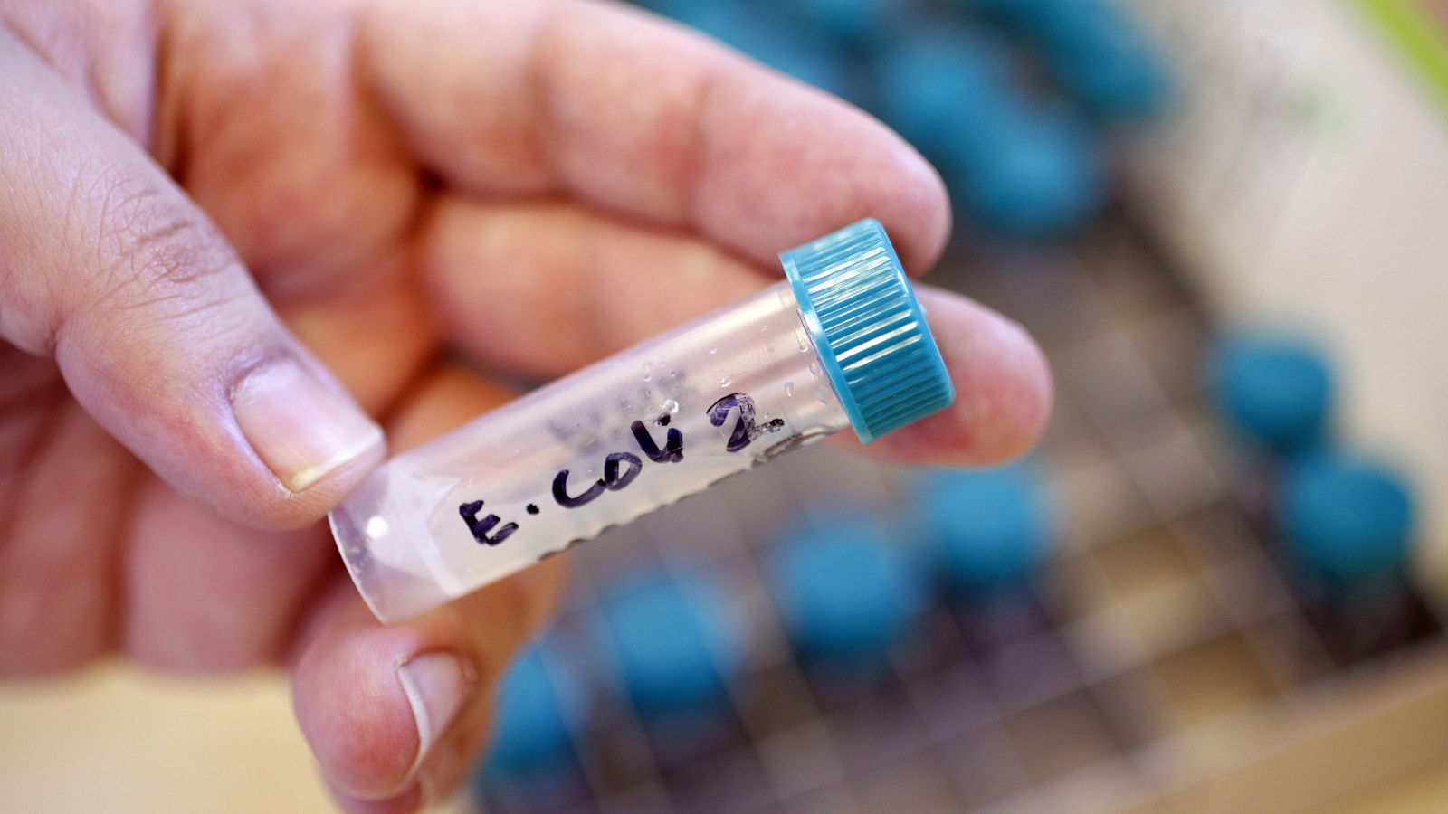 Foto: Un científico británico sostiene una muestra de una bacteria E.coli. (Reuters)