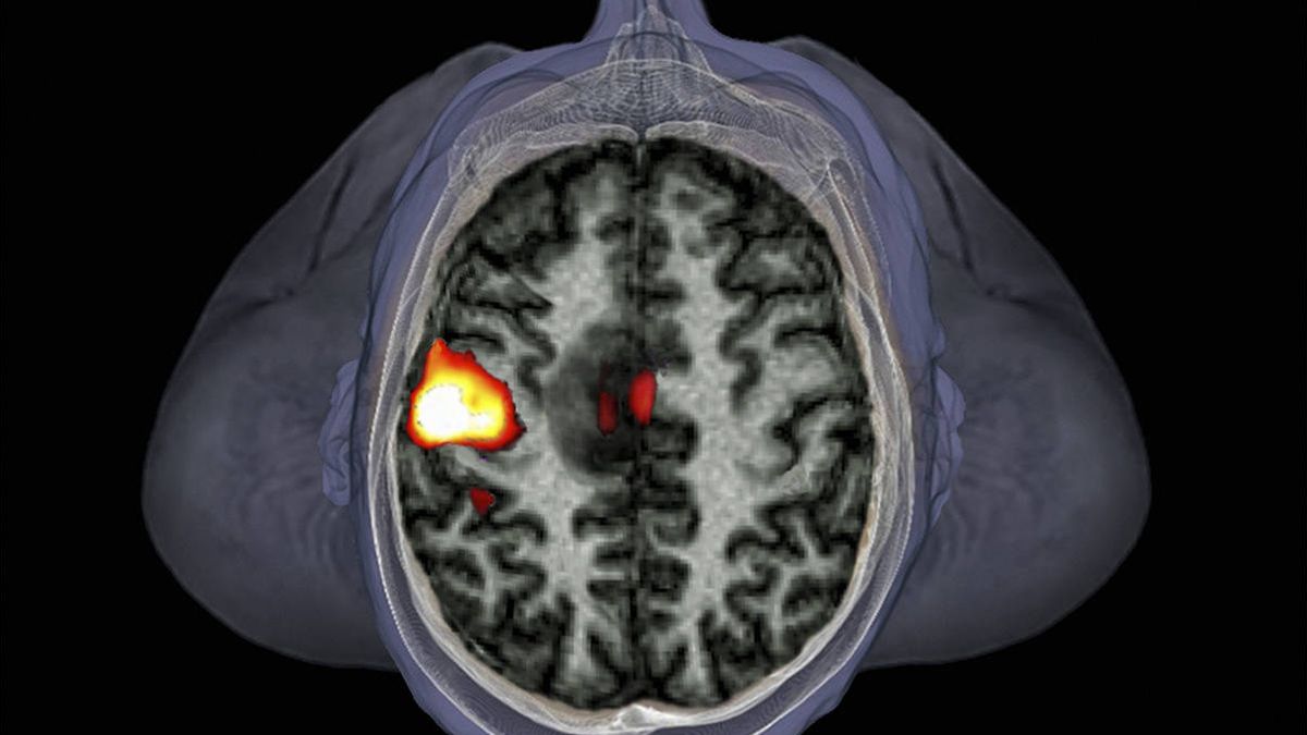 Cien mil escáneres del cerebro para derrotar a las enfermedades mentales