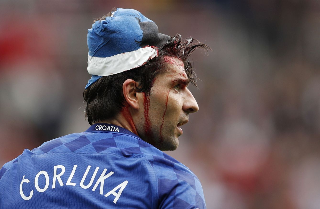 Corluka sufrió un fuerte golpe en la cabeza (John Sibley/Livepic/Reuters)