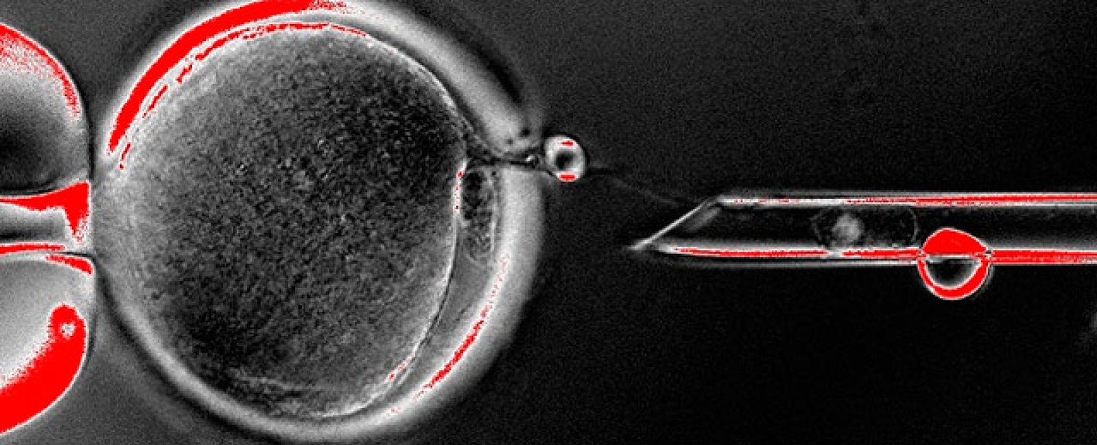 Foto: Avance histórico: la ciencia consigue  células embrionarias humanas mediante clonación