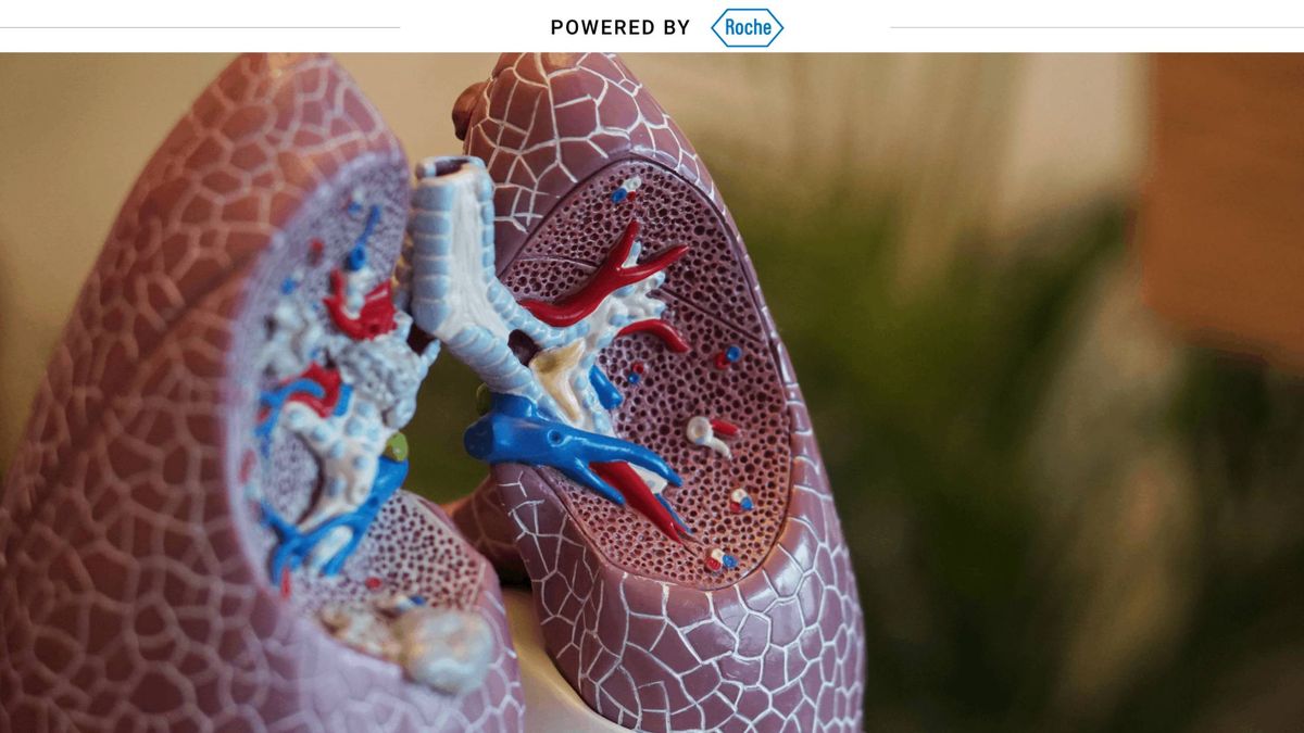 Cáncer de pulmón, una realidad en tiempos de coronavirus
