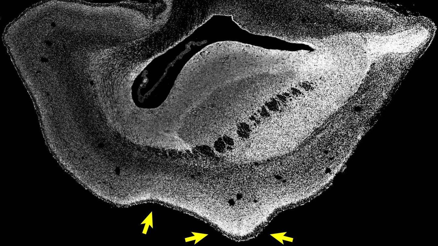 Imagen microscópica de una sección a través de un hemisferio cerebral de un feto de tití transgénico de 101 días de edad . Foto: Max Planck Institute