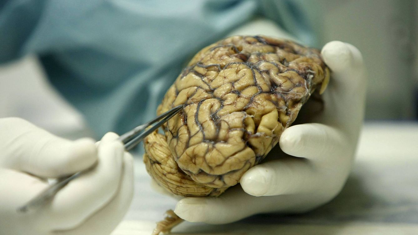 Foto: Cerebro de un banco de tejidos neurológicos. (EFE/Fernando Alvarado)