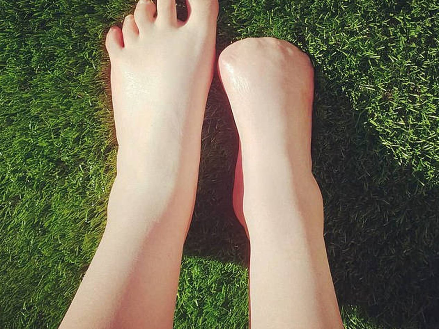 La mujer se ha quedado sin los cinco dedos de su pie (Foto: Instagram)