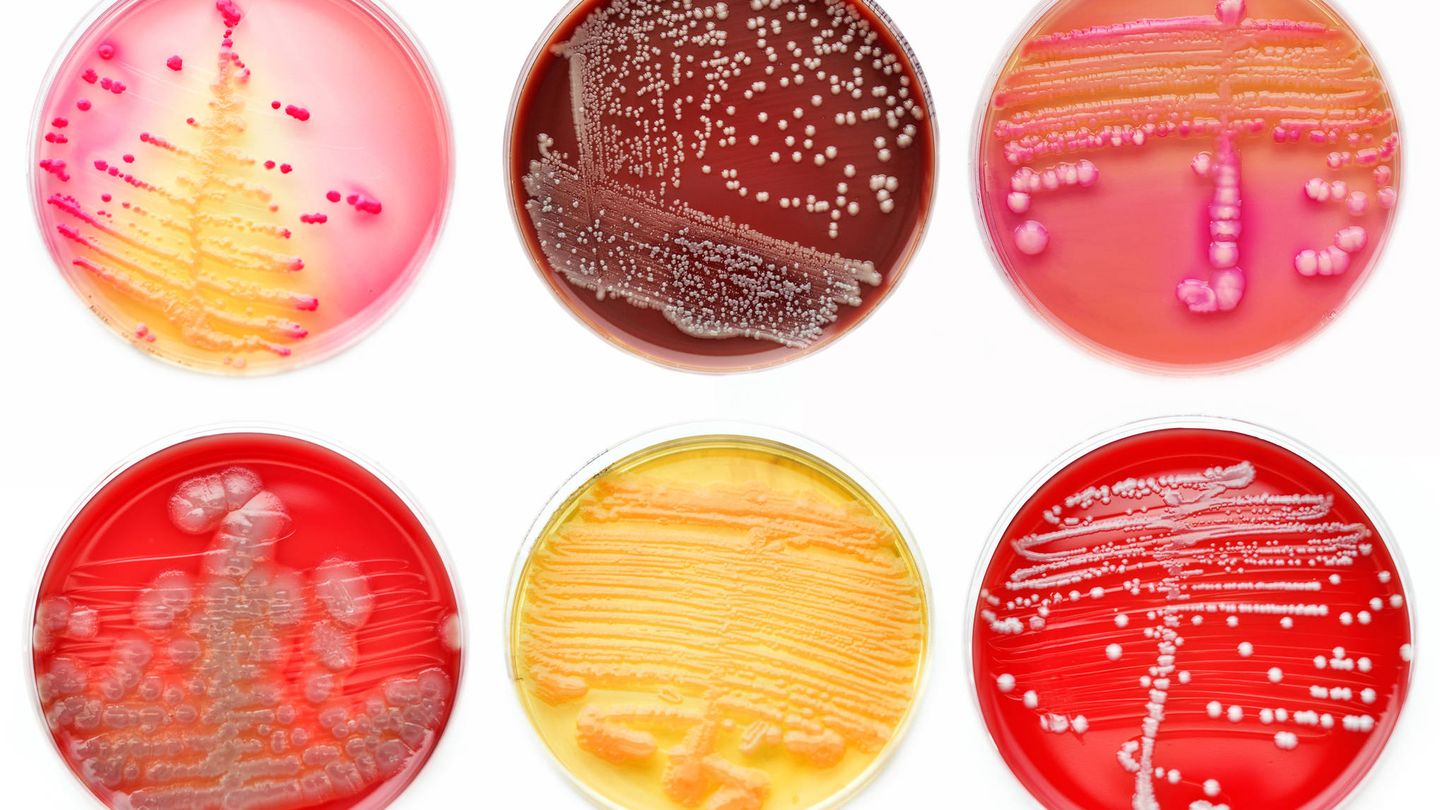 Cultivos de bacterias en placas de petri. (iStock)