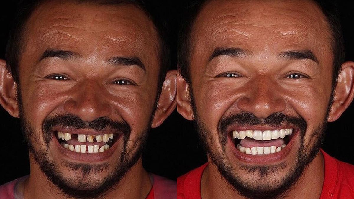 Un dentista solidario viaja por el mundo trabajando gratis "por una sonrisa"