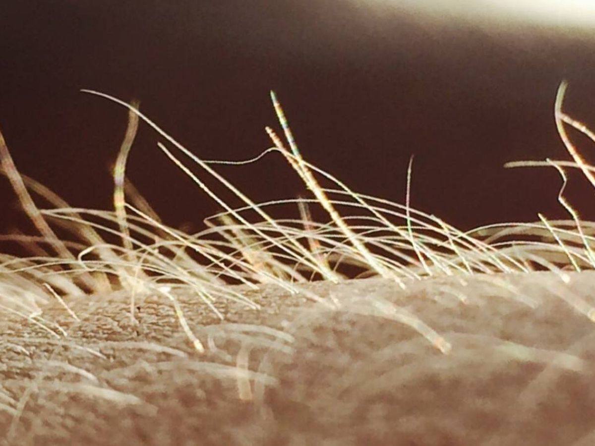 Pesquisadores identificam órgão sensorial que desencadeia a sensação de coceira por meio de pelos