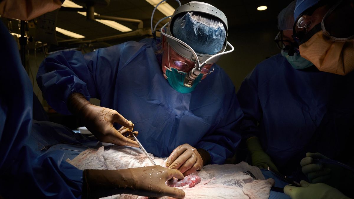 ¿Qué novedades aporta el primer trasplante renal de cerdo transgénico?