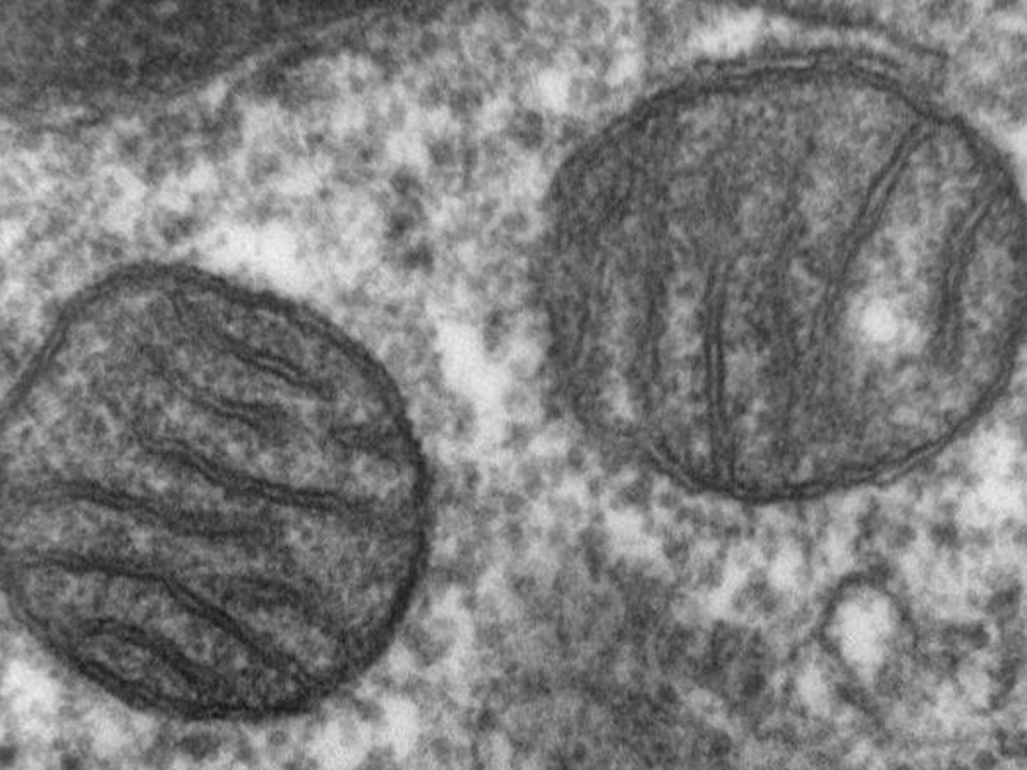 Dos mitocondrias, al microscopio. (Wikipedia)
