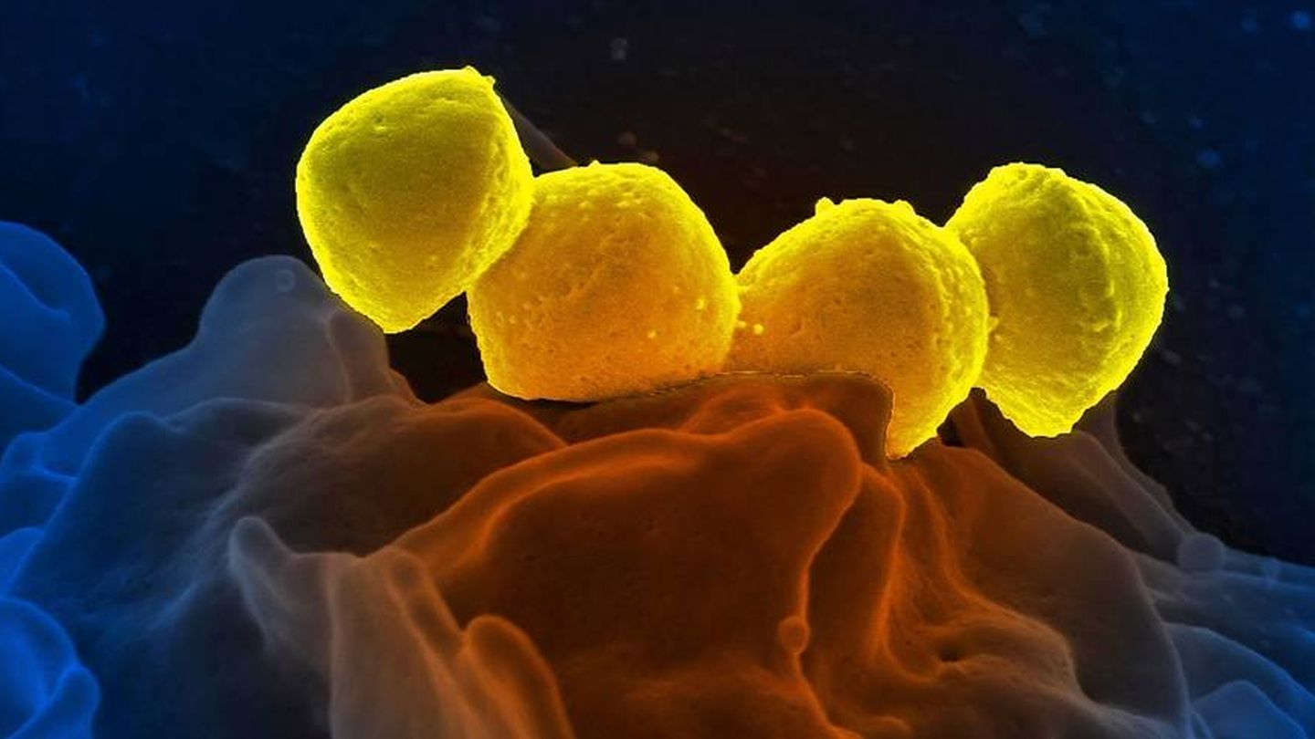 Bacterias resistentes al antibiótico. (CDC on Unsplash)