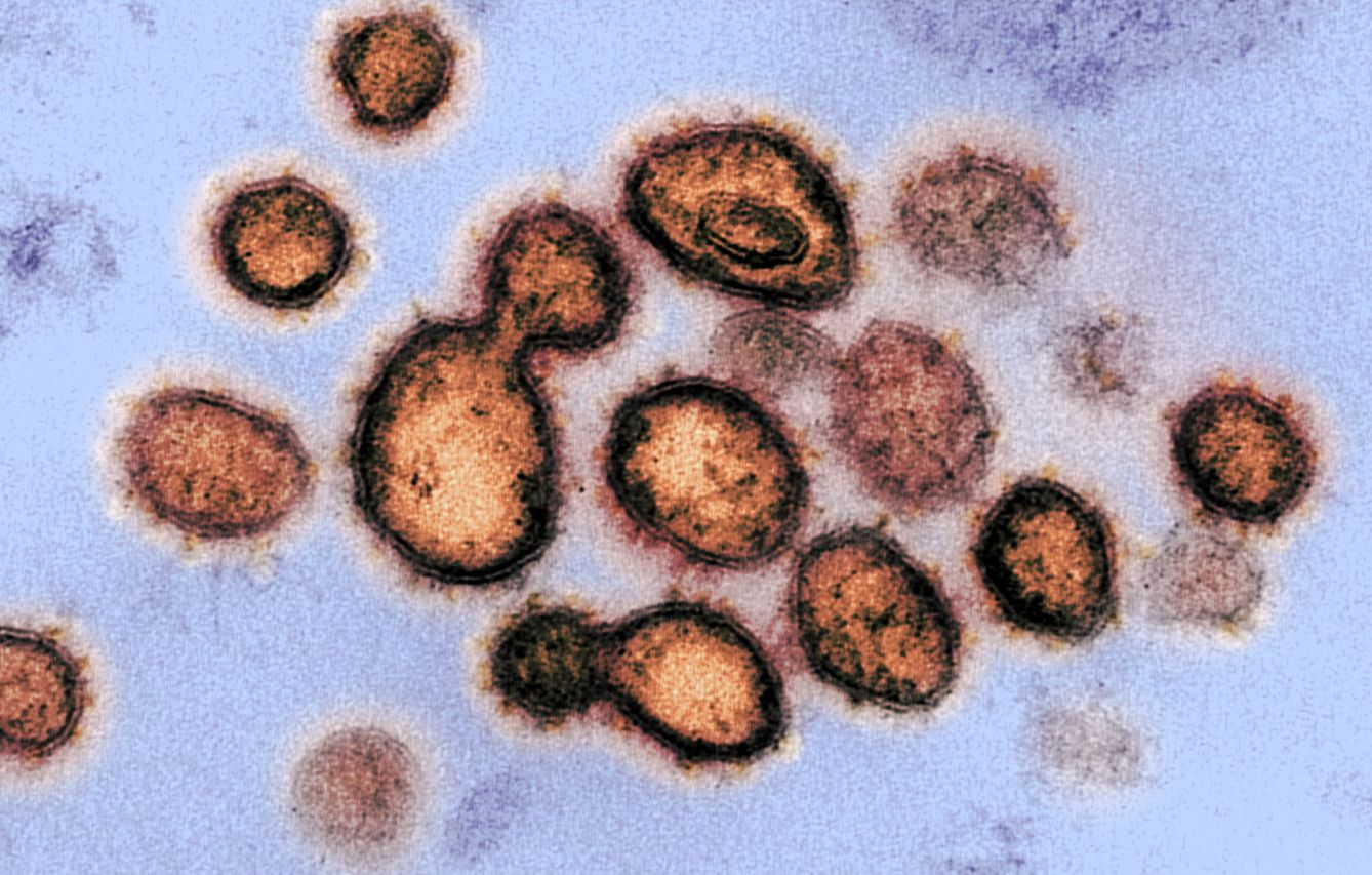 Una muestra del SARS-CoV-2, el virus que causa la enfermedad infecciosa COVID-19, aislado en un paciente de EEUU. (EFE)