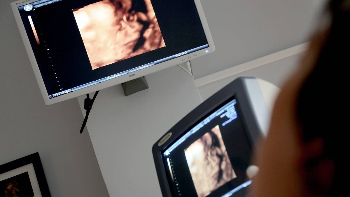 Eslovaquia debate obligar a las mujeres a escuchar los latidos del feto antes del aborto