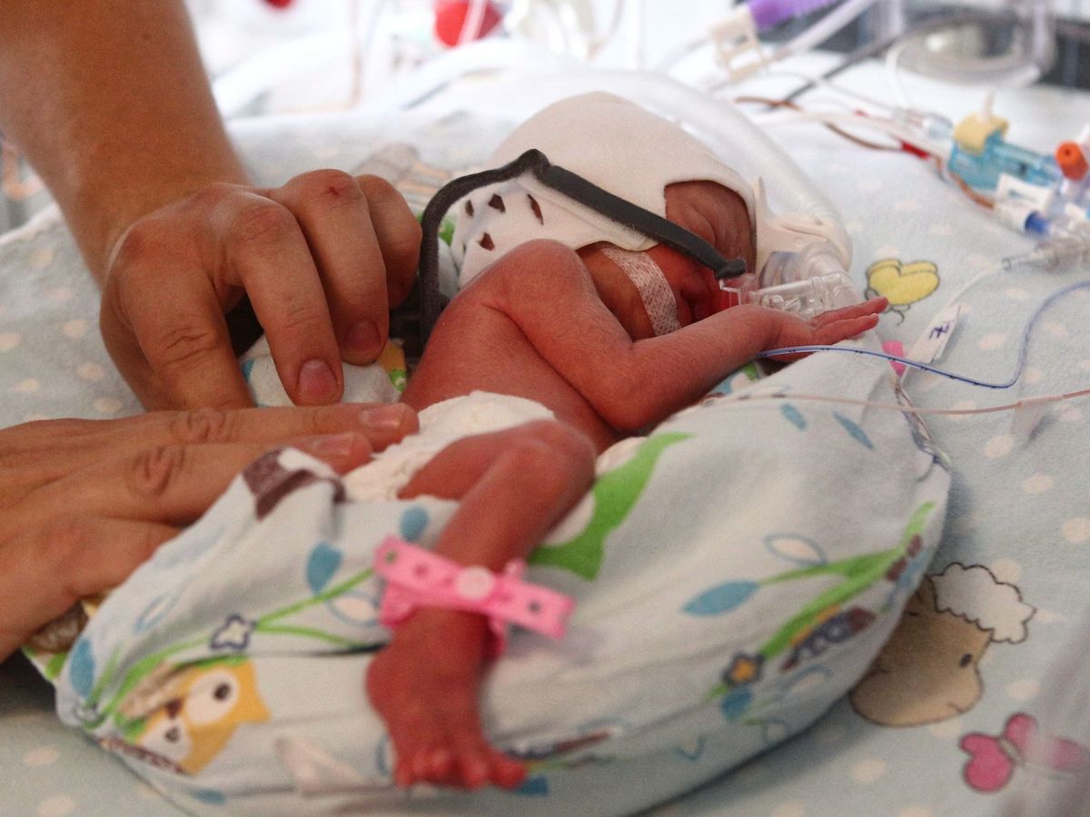 Foto: Los bebés prematuros tienen más posibilidades de sufrir infecciones