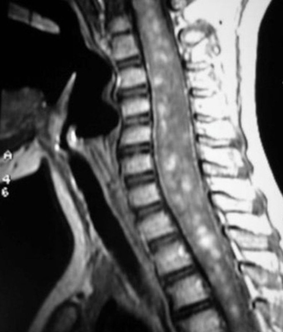 Foto: Científicos estadounidenses logran crear una médula espinal artificial para pruebas médicas