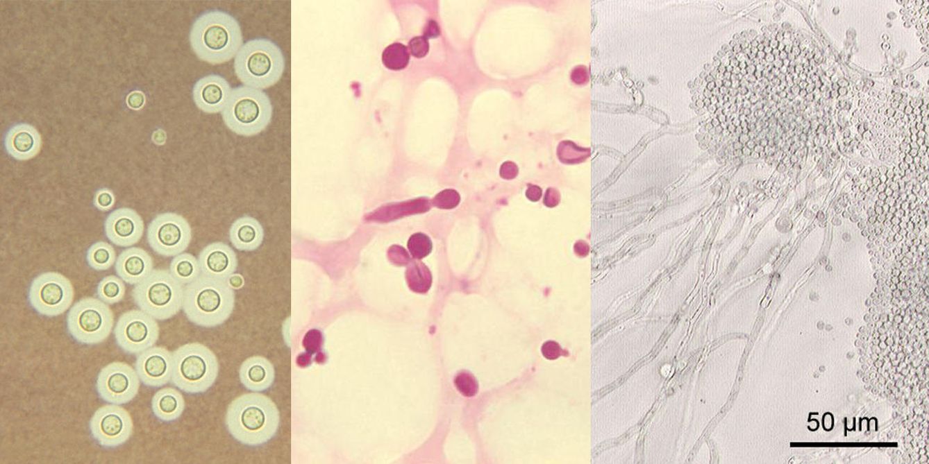'Cryptococcus spp'. y 'Malasezzia spp' y 'Candida albicans', los tres hongos que podrían estar relacionados con la ELA. (Creative Commons)