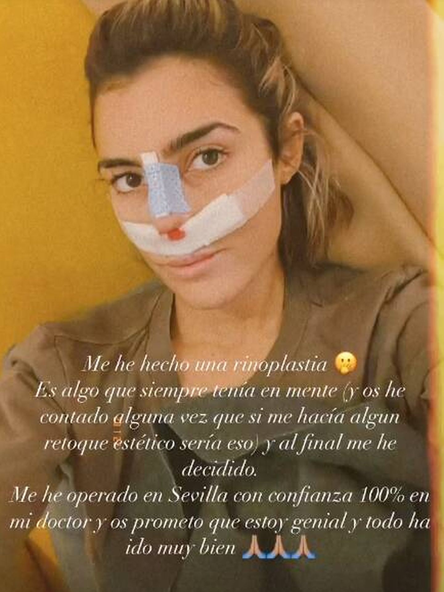 La hija de Paz Padilla, tras su operación de nariz. (Instagram @annafpadilla)