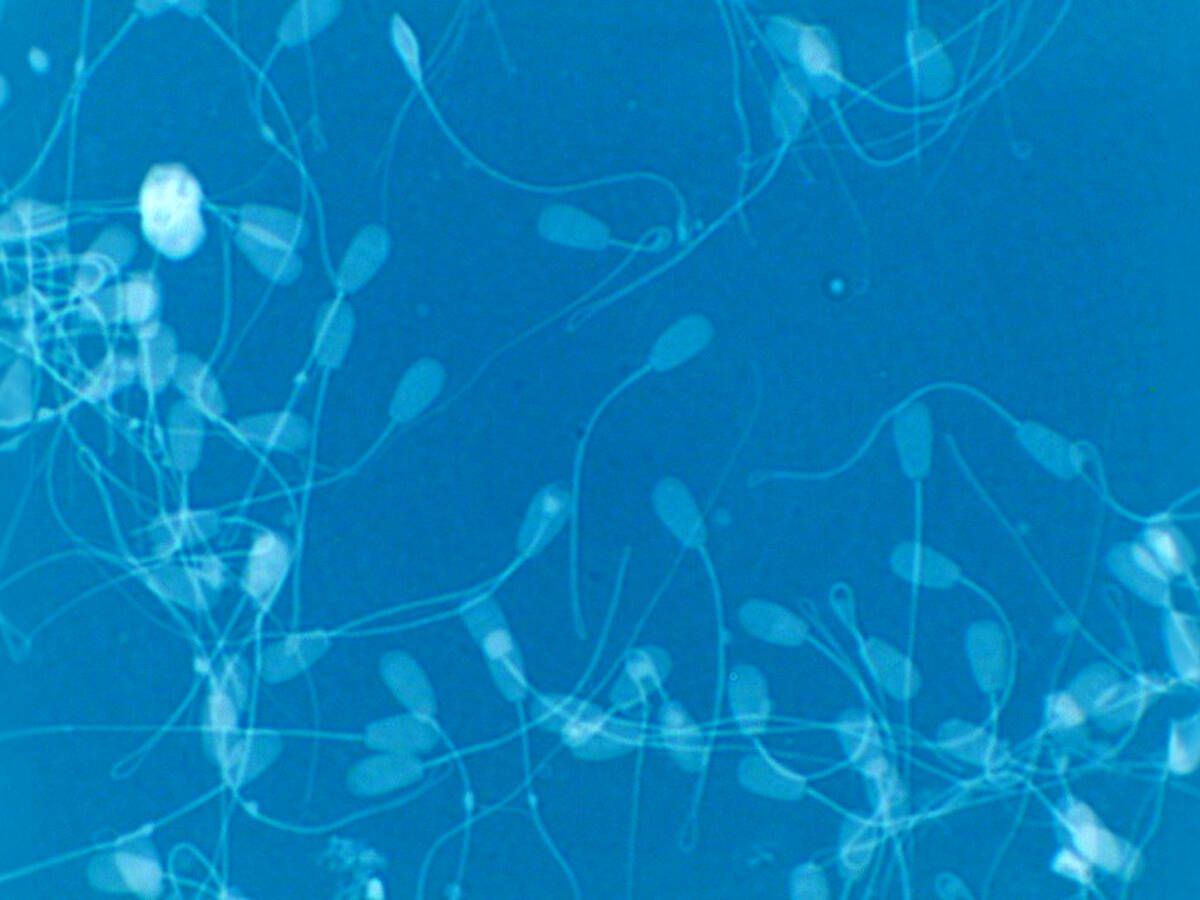 Foto: Espermatozoides bajo el microscopio. (WikiCommons/Jlipuma1)