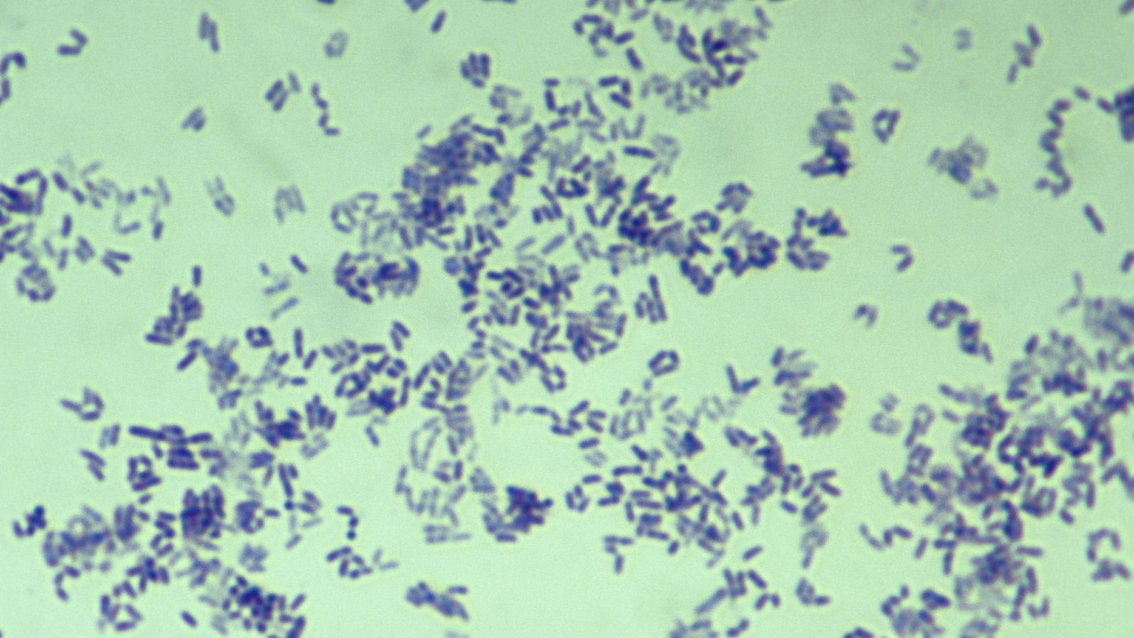 Foto: La bacteria de la Difteria vista a través del microscopio. (Corbis)