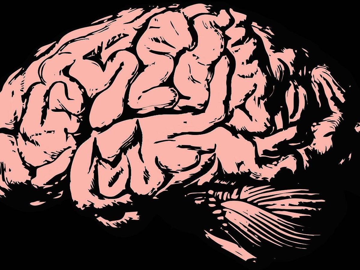 Foto: Las lecturas de un escáner cerebral serían un objetivo clave en psiquiatría. (Pixabay)