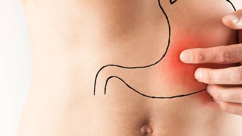 Úlcera gástrica: ¿cuál es (de verdad) el tratamiento?