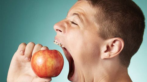 La boca más grande del mundo es de un niño de 14 años: le cabe una manzana entera