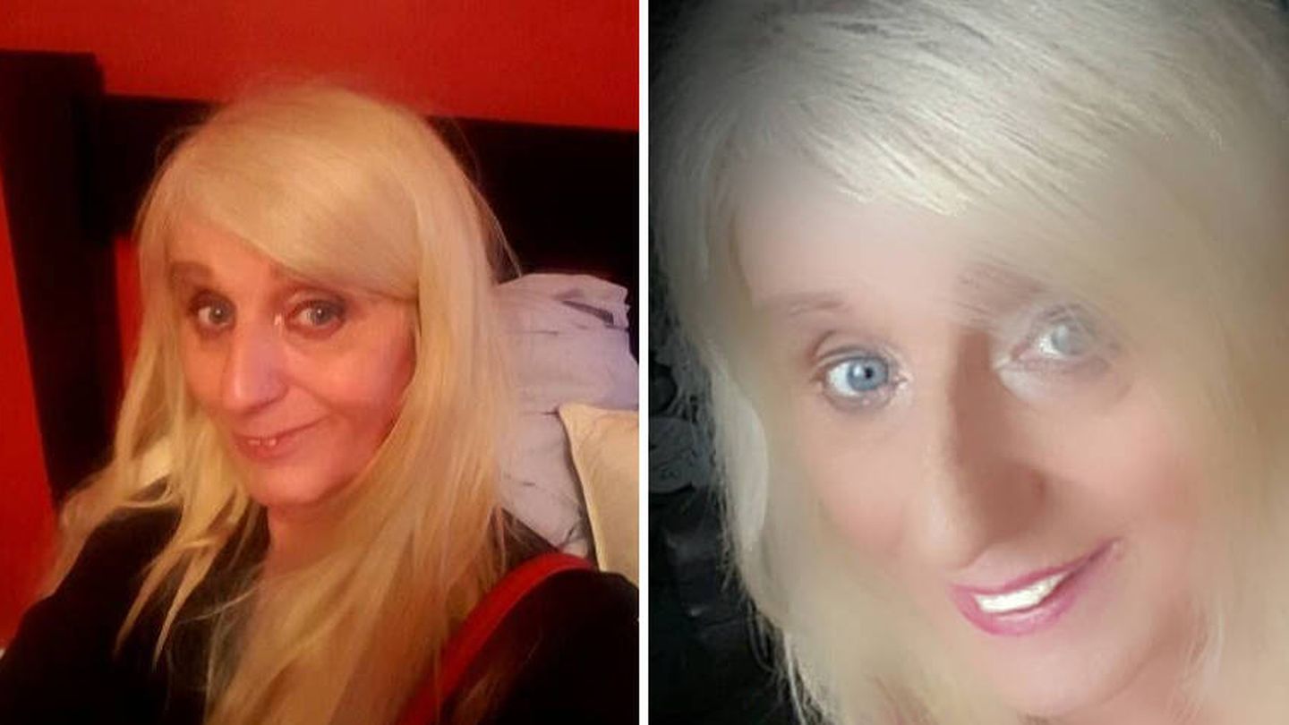 La transformación de Melissa tras retocarse la boca ha sido impresionante (Foto: Facebook)