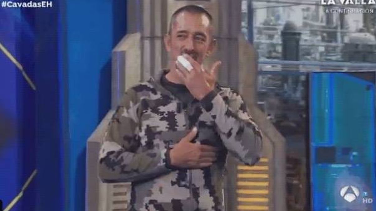 El feroz motivo por el que el doctor Pedro Cavadas ha aparecido con un dedo vendado en 'El hormiguero'