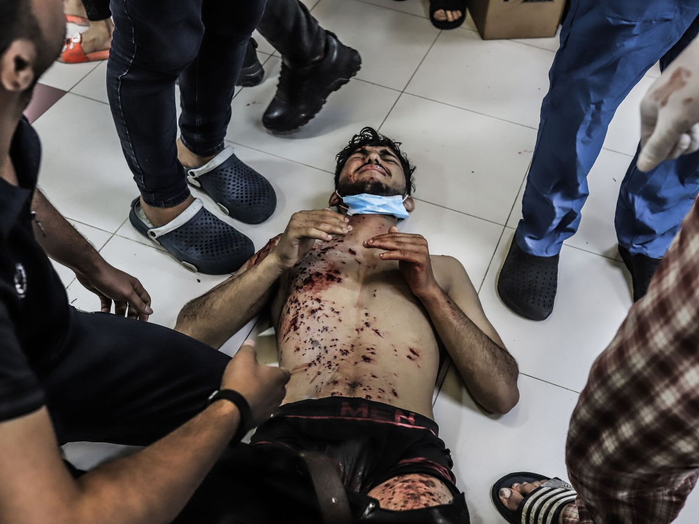 Un palestino, herido, en el suelo del hospital Al Shifa, en Gaza. (DPA/Mohammad Abu Elsebah)