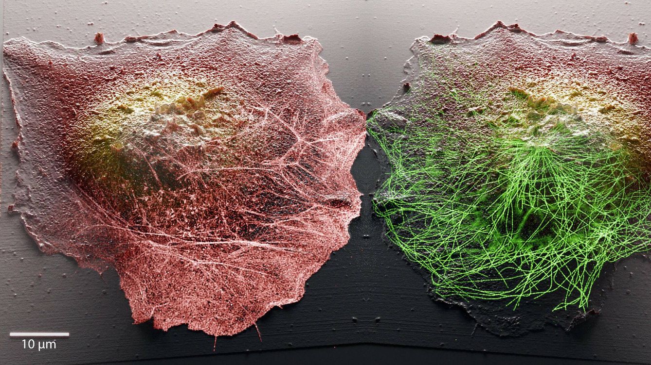 Foto: Increíbles imágenes tridimensionales que ofrecen una vista sin precedentes del funcionamiento de las células vivas (EPFL)