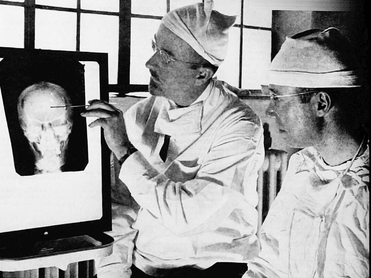 Foto: El Dr. Walter Freeman y el Dr. James W. Watts, frente a una radiografía tras un tratamiento psicoquirúrgico.