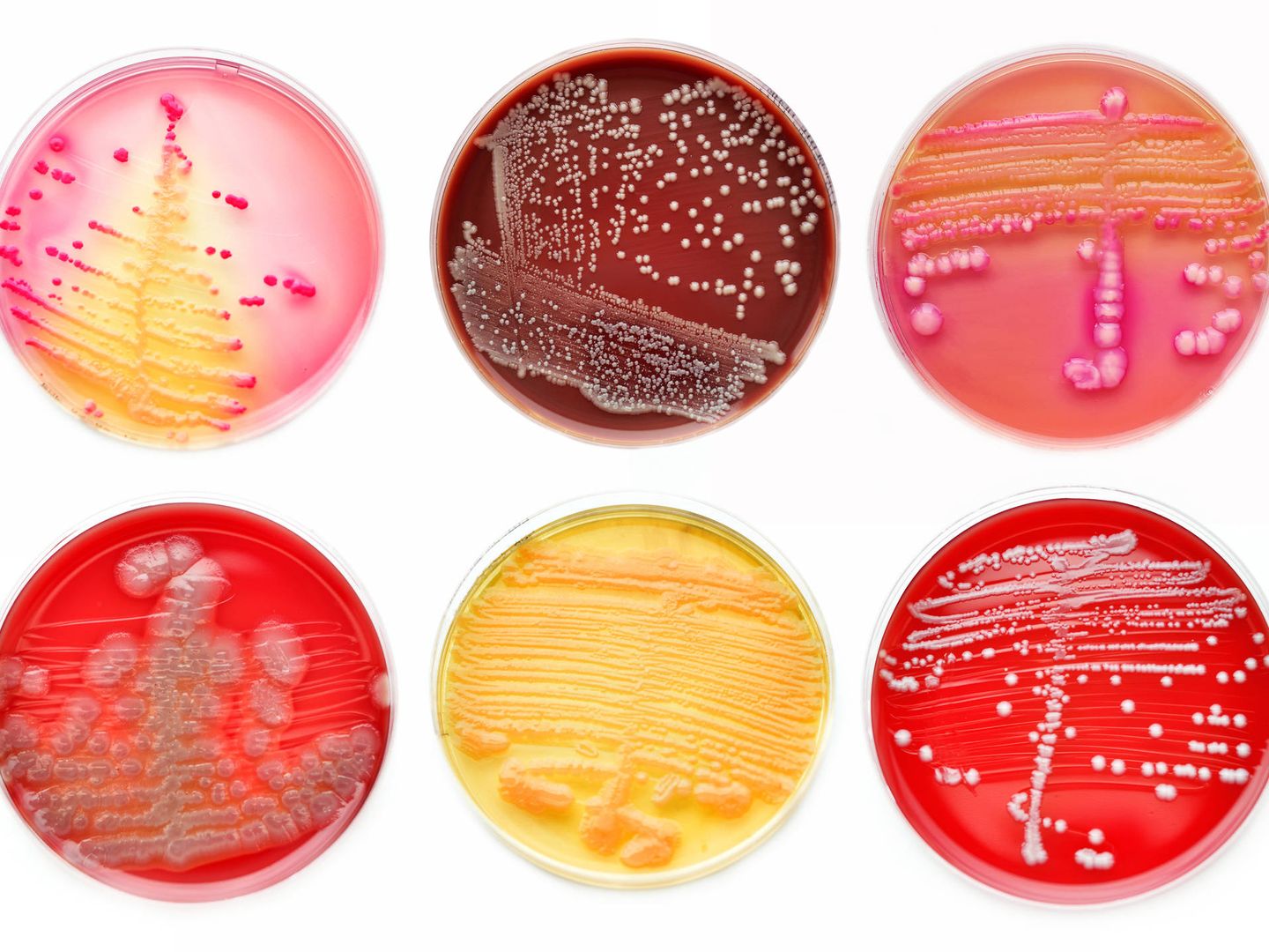 Cultivos de bacterias en placas de petri. (iStock)
