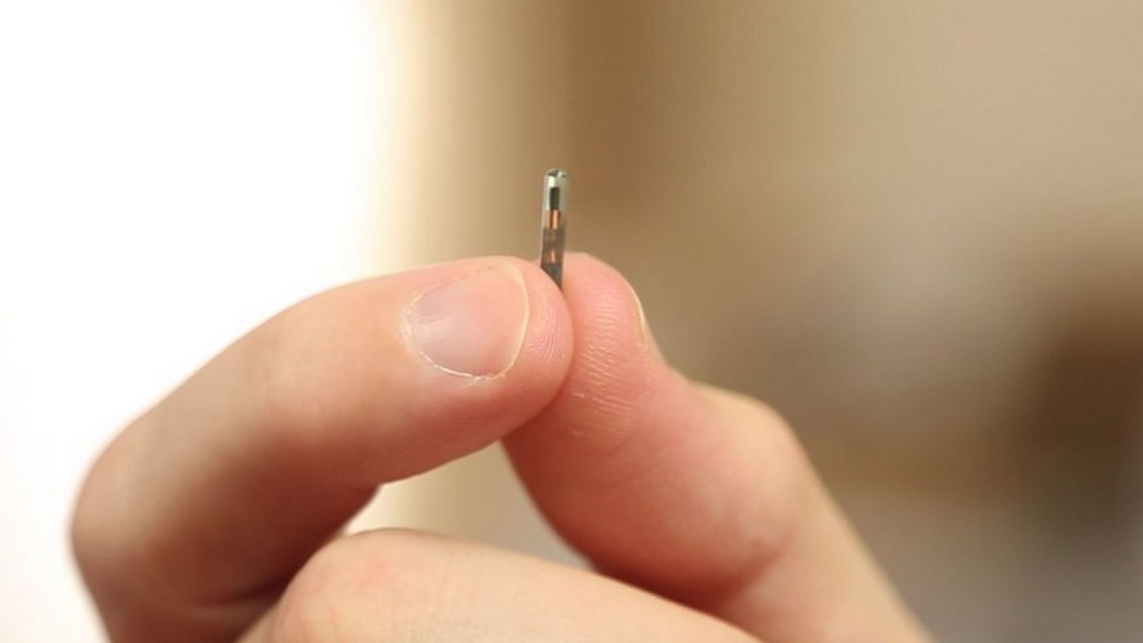 Foto: La implantación de chips corporales marcará el camino de la medicina