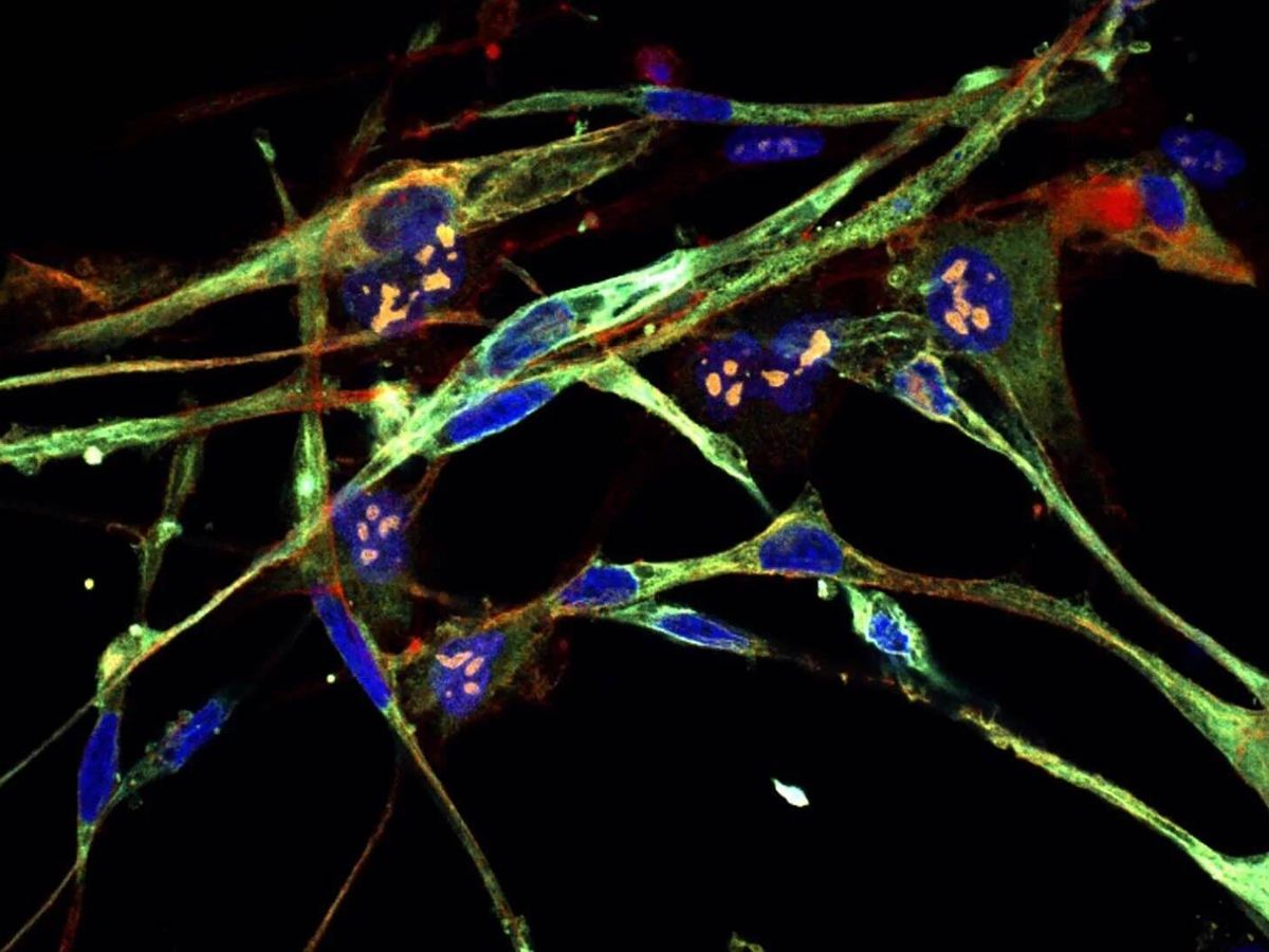 Foto: Células de rabdomiosarcoma trasformadas en células musculares. (Laboratorio Cold Spring Harbor)
