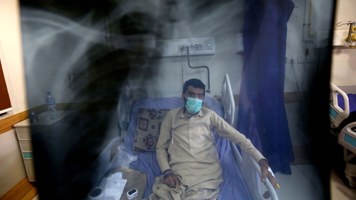 Enfermo de tuberculosis en Pakistán. (EFE)