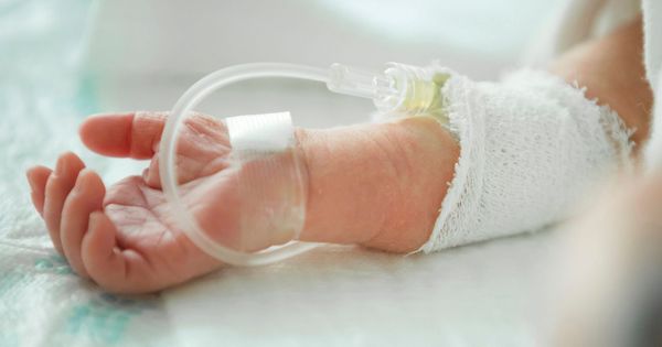 Foto: Un neonato, nacido prematuramente, recibe alimentación intravenosa en el interior de una incubadora. (EFE)
