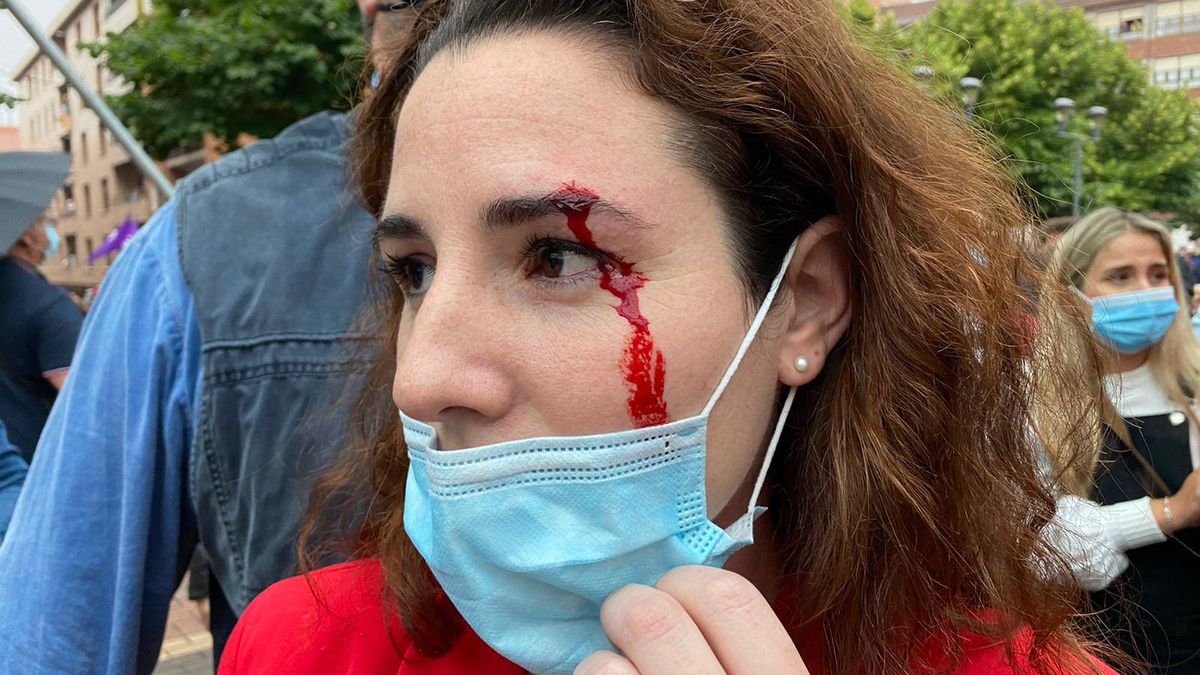 Herida una diputada de Vox al recibir una pedrada en un mitin en Sestao (Vizcaya)