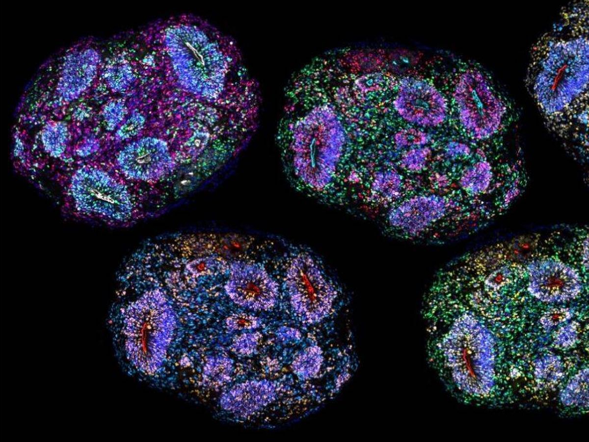 Cientistas mantêm órgãos cerebrais humanos cultivados em laboratório por quase seis anos