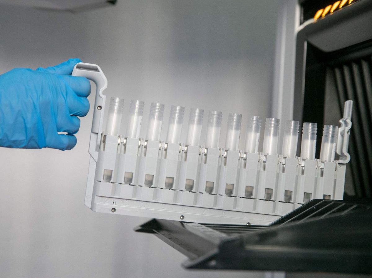 Foto: Vista de las probetas para los test PCR en el laboratorio de análisis del Hospital Clínico Lozano Blesa de Zaragoza. (EFE) 