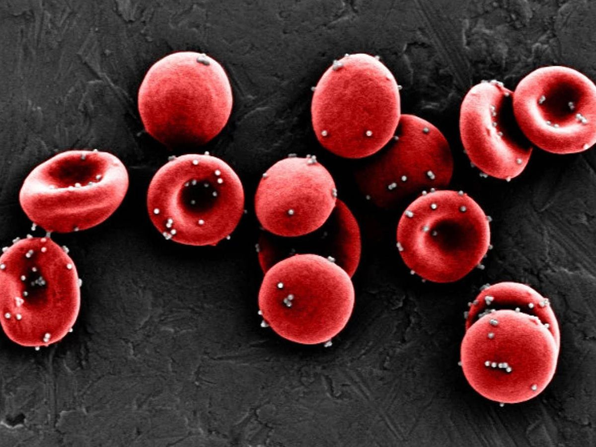 Foto: Las nanopartículas recubiertas de un antígeno se adhieren a los glóbulos rojos. Foto: Instituto Wyss de la Universidad de Harvard.