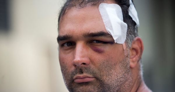 Foto: El turista José Bravo, que fue agredido por un grupo de manteros en la plaza Cataluña de Barcelona. (EFE)