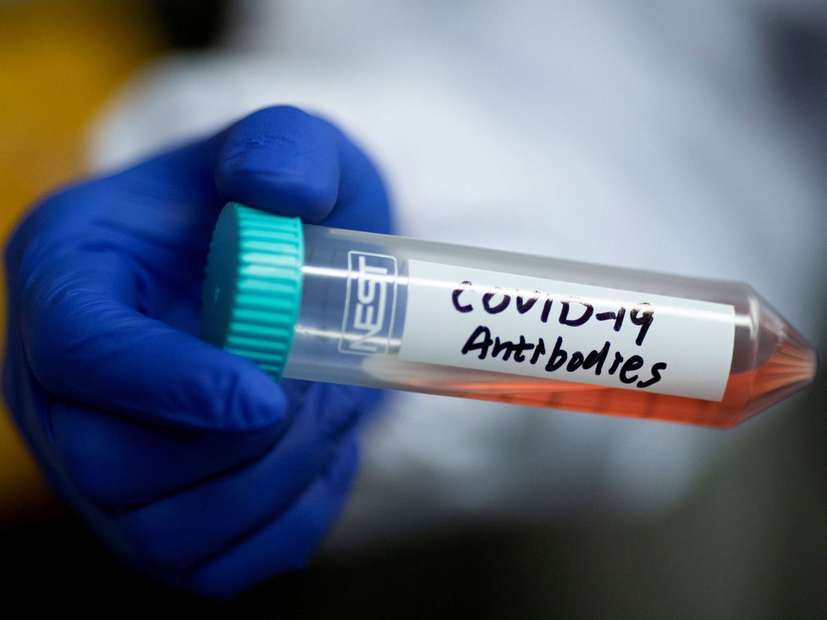 Foto: Investigación del coronavirus y los anticuerpos en un laboratorio de China. (Reuters)