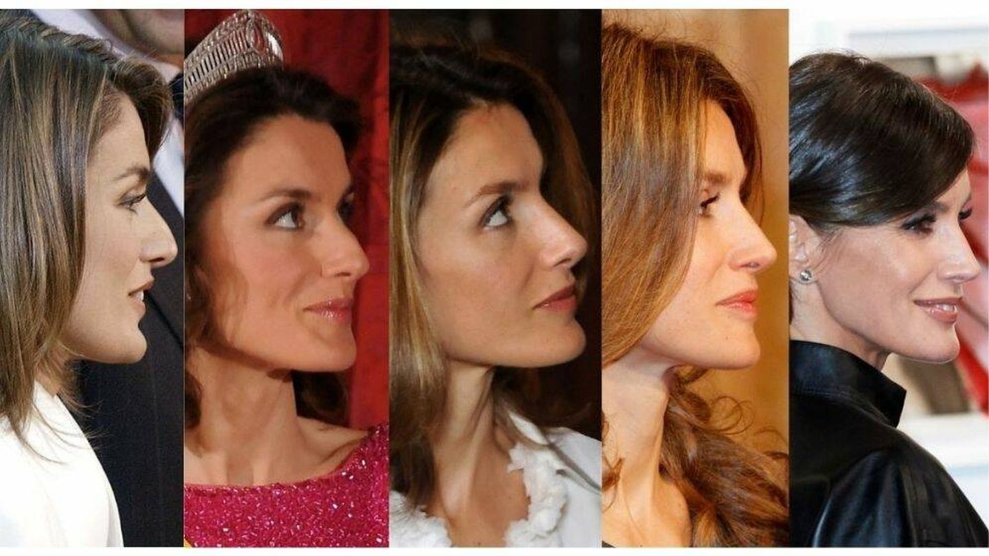 La reina Letizia, antes y después de la rinoplastia. (Getty / Cordon Press)