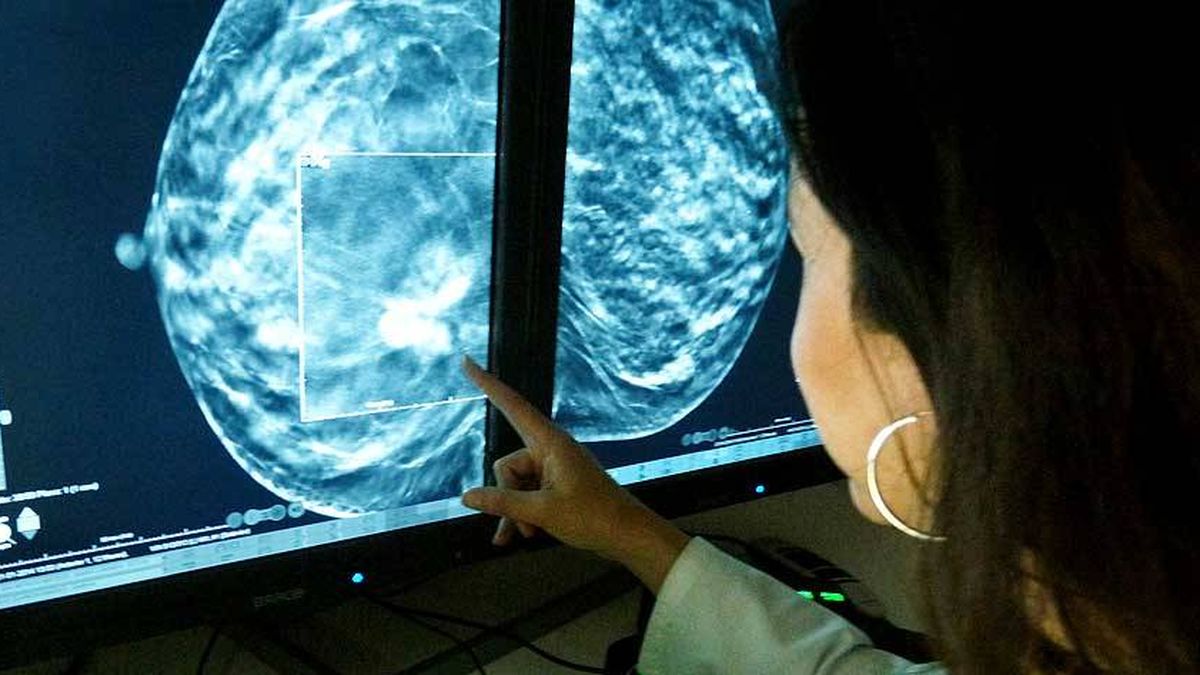 "La tomosíntesis permite detectar un 40% más de tumores que la mamografía"