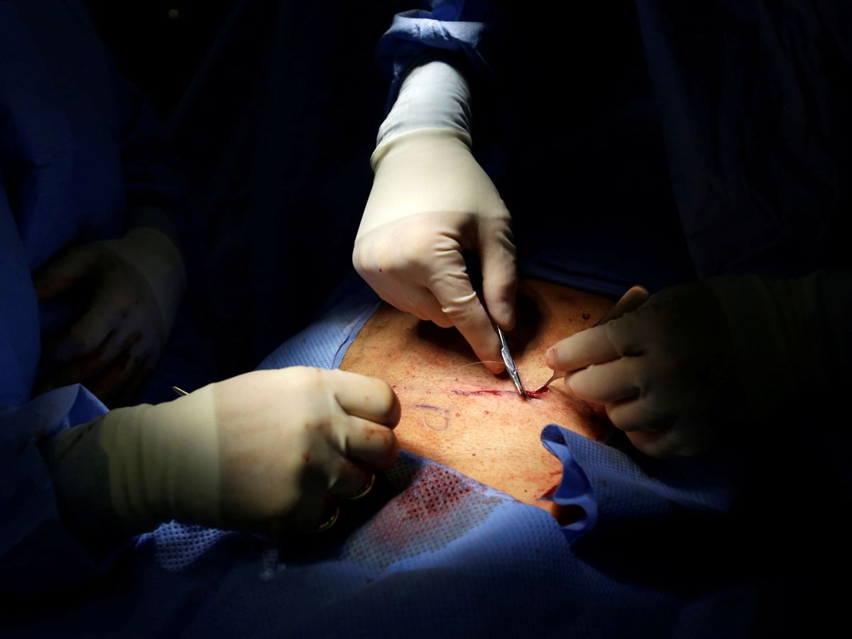 Foto: Un equipo médico practica una operación de hernia inguinal. (Reuters)
