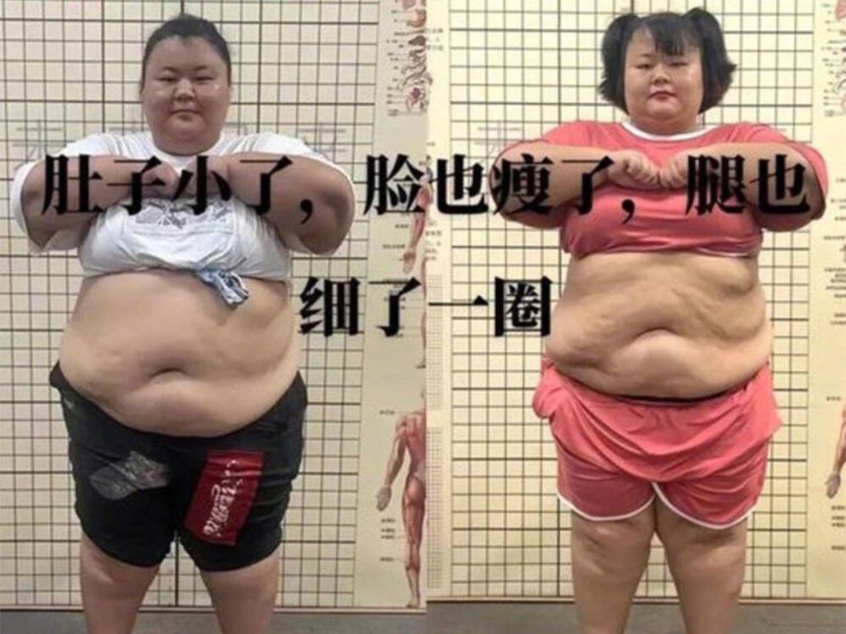 Foto: Muere una joven de 21 años que pesaba 156 kilos en un campamento para adelgazar de China (Weibo)