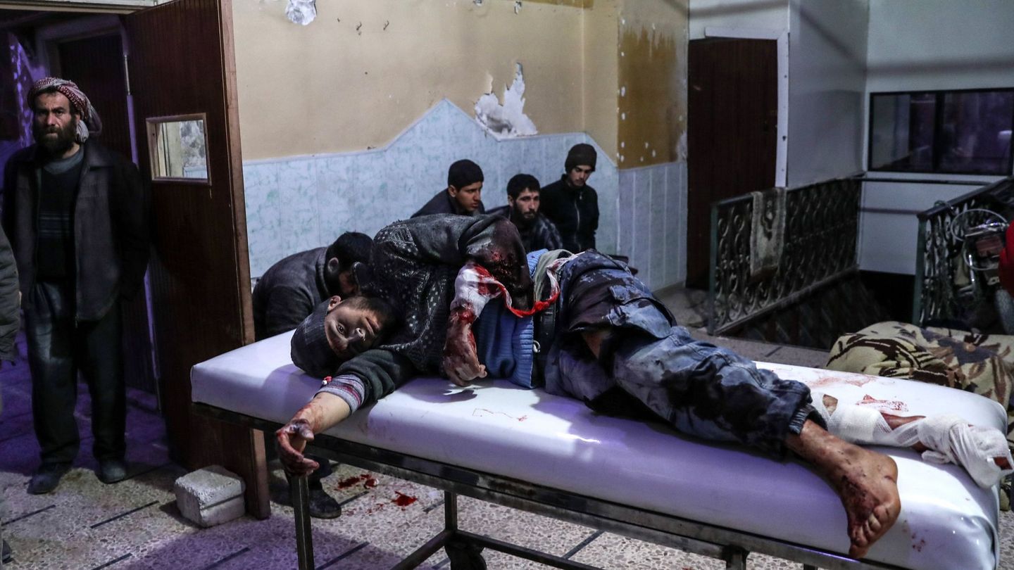  Un hombre herido tras un bombardeo al este de Guta es atendido en un hospital de Duma, en Siria. (EFE)