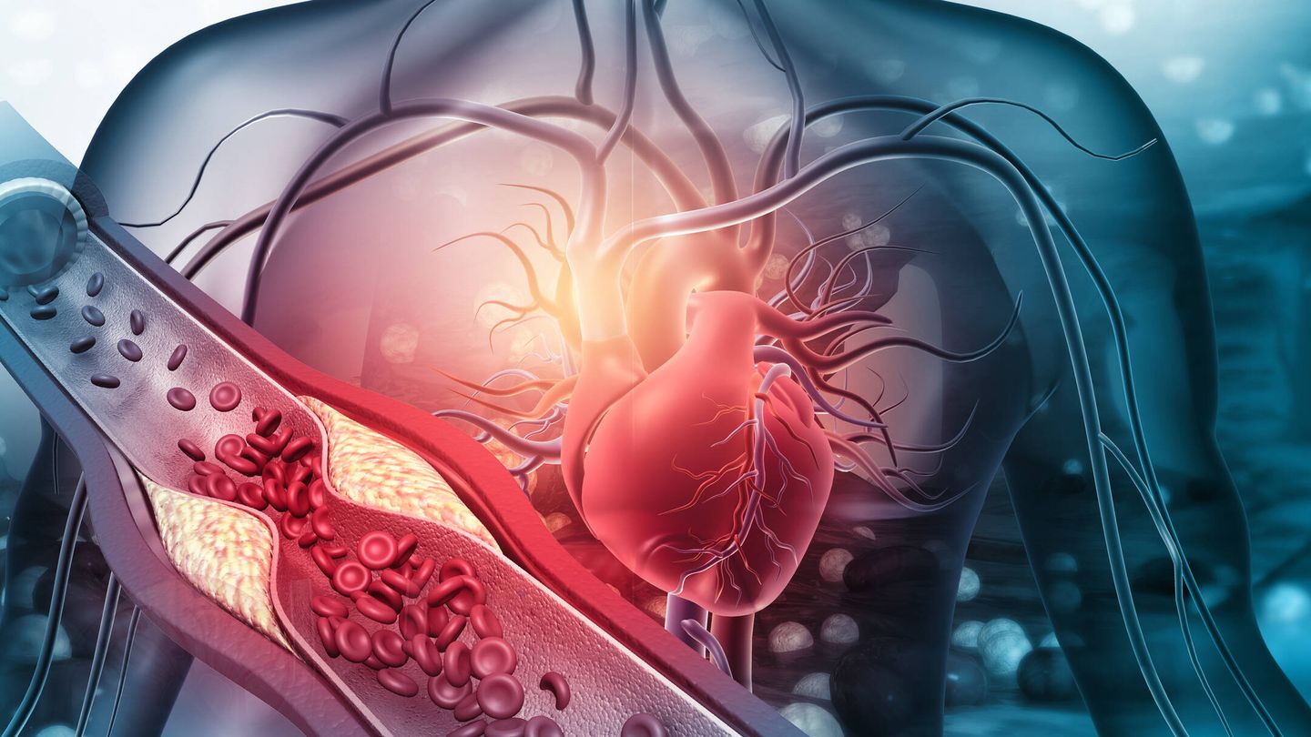 Unos niveles de colesterol altos aumentan el riesgo de sufrir enfermedades cardiovasculares.