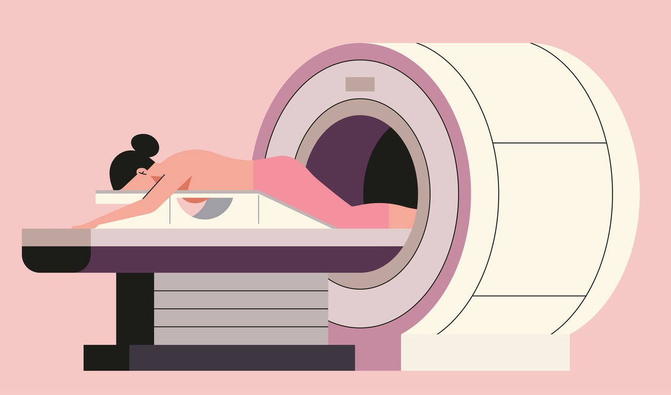 La resonancia magnética es útil en mujeres con mamas densas, pero por ahora no hay suficiente evidencia científica (Foto: iStock)