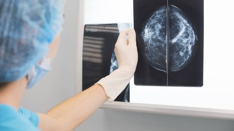 Adiós a las mamografías: detectar el cáncer de mama en 2 minutos, gastando menos energía que un 'smartphone'