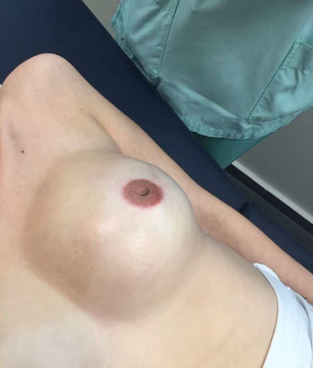 Imagen de una mama tatuada en el Hospital Universitario de Torrejón. (A.Q)